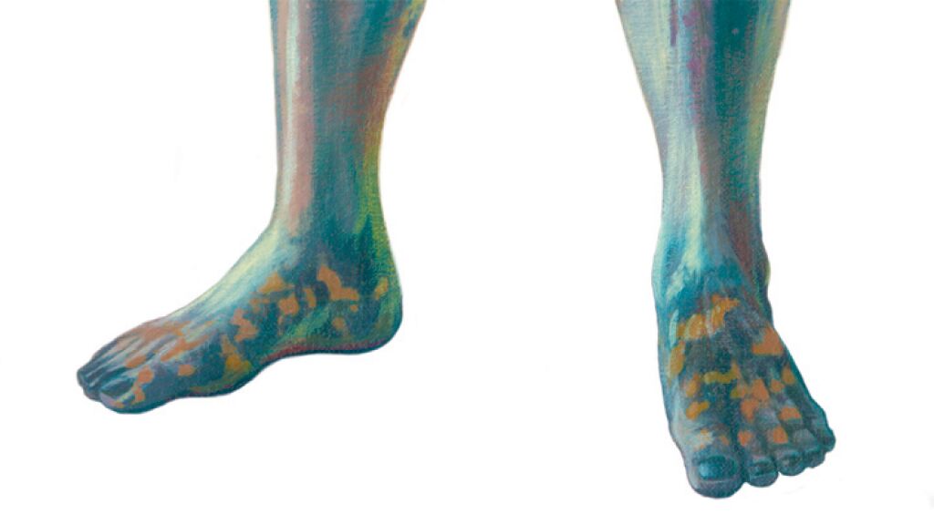 Europe's IronandClay Unity