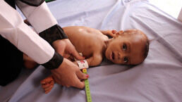 Famine Is on the Verge of a Major Comeback