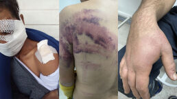 Croatian Police Systematically Torturing Migrants